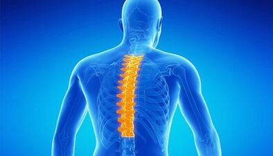 Kas yra juosmens stuburo osteochondrozė